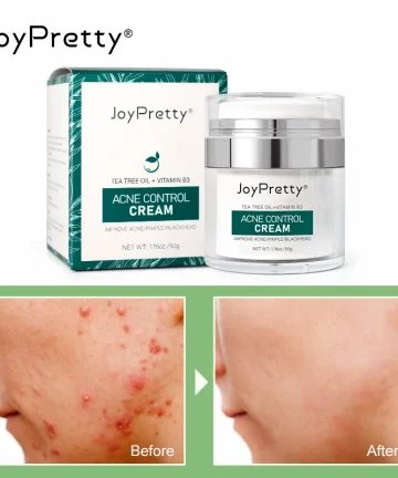 JoyPretty Tea Tree Treatment Face Cream